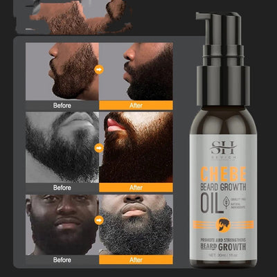 beard growth oil

beard grooming kit

natural beard care

beard growth booster

premium beard treatment

beard softening serum

full beard solution

beard thickening formula

beard care essentials

men’s grooming product

healthy beard oil

fast beard growth

beard conditioning blend

sleek beard finish

