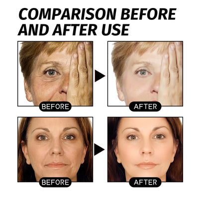 skin lifting face mask

firming and tightening mask

glow boosting facial mask

anti aging face treatment

collagen boosting mask

wrinkle reduction face mask

skin elasticity mask

brightening and hydrating mask

rejuvenating facial mask

natural firming skincare

face mask for sagging skin

nstant glow face mask

anti wrinkle lifting mask

moisture rich lifting mask

radiance boosting skin treatment

