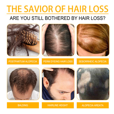 hair growth serum

hair thickening solution

anti-hair loss treatment

nourish hair roots

scalp repair formula

hair regrowth booster

natural hair revitalizer

hair follicle stimulator

healthy hair serum

breakage prevention

hair shine enhancer

daily hair care serum

restore thinning hair

nutrient-rich hair formula

deep hair nourishment

hair repair essence

