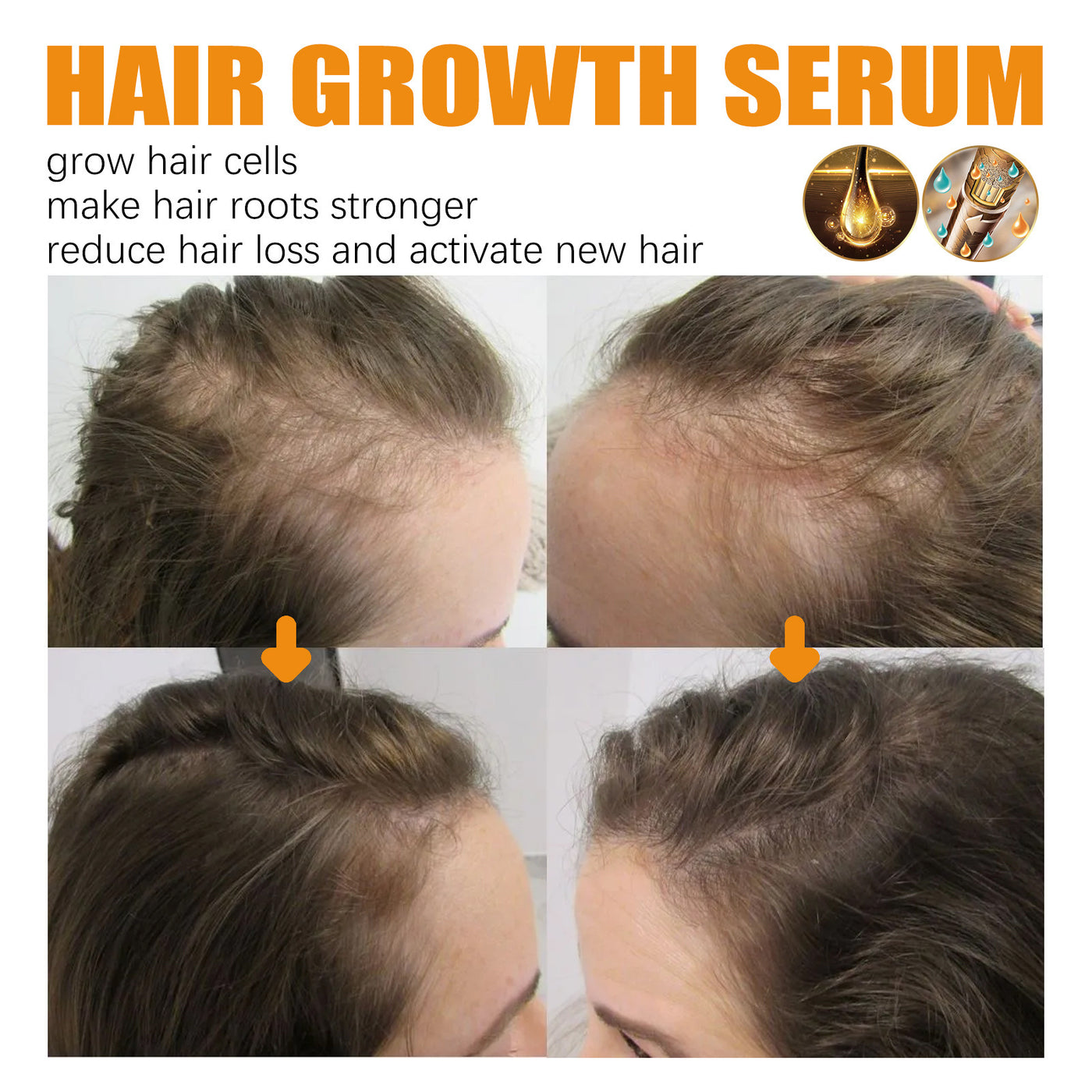 hair growth serum

hair thickening solution

anti-hair loss treatment

nourish hair roots

scalp repair formula

hair regrowth booster

natural hair revitalizer

hair follicle stimulator

healthy hair serum

breakage prevention

hair shine enhancer

daily hair care serum

restore thinning hair

nutrient-rich hair formula

deep hair nourishment

hair repair essence


