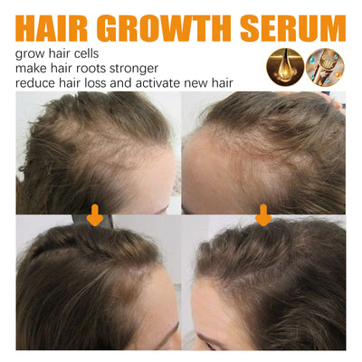 hair growth serum

hair thickening solution

anti-hair loss treatment

nourish hair roots

scalp repair formula

hair regrowth booster

natural hair revitalizer

hair follicle stimulator

healthy hair serum

breakage prevention

hair shine enhancer

daily hair care serum

restore thinning hair

nutrient-rich hair formula

deep hair nourishment

hair repair essence

