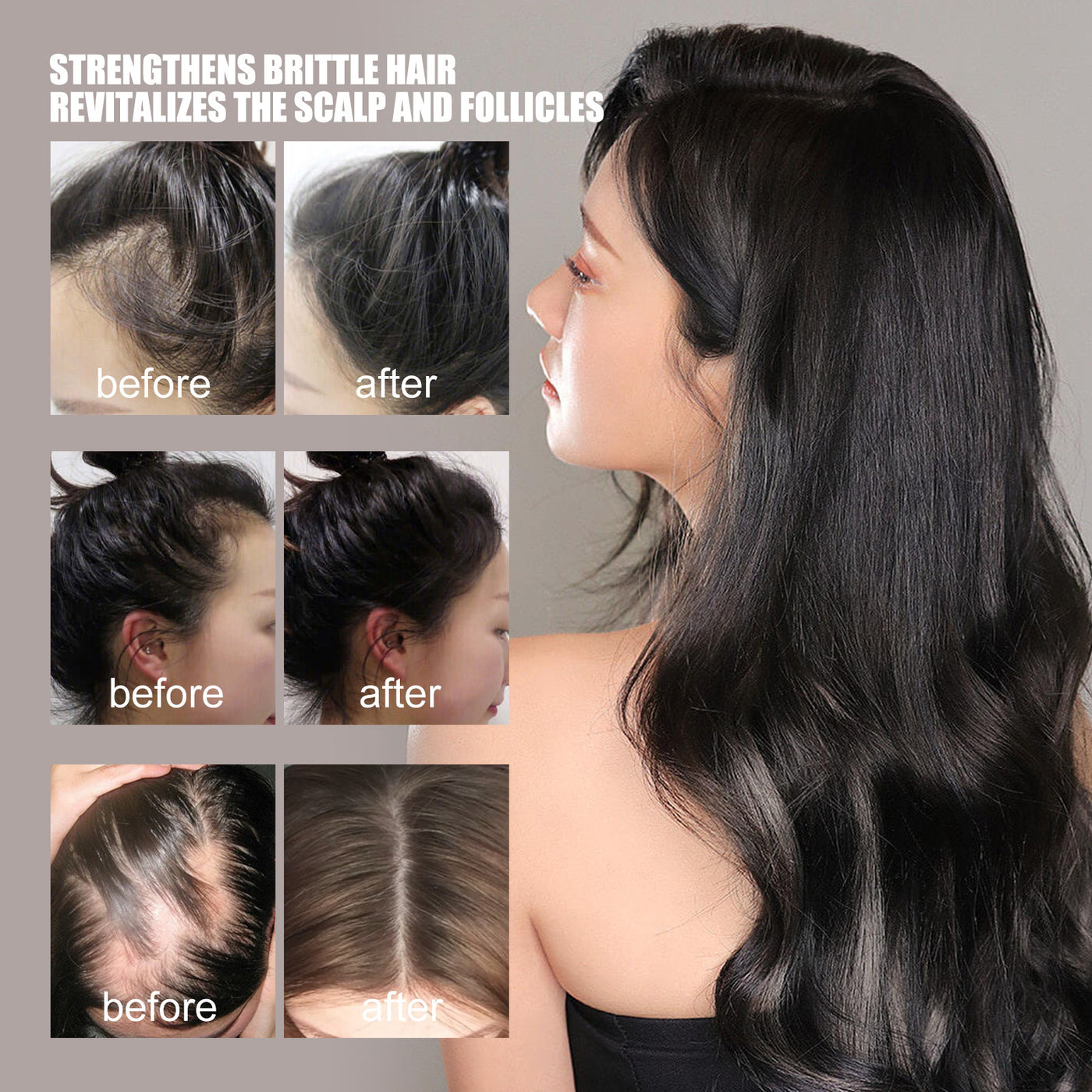 hair growth serum

hair thickening solution

anti-hair loss treatment

nourish hair roots

scalp repair formula

hair regrowth booster

natural hair revitalizer

hair follicle stimulator

healthy hair serum

breakage prevention

hair shine enhancer

daily hair care serum

restore thinning hair

nutrient-rich hair formula

deep hair nourishment

hair repair essence

