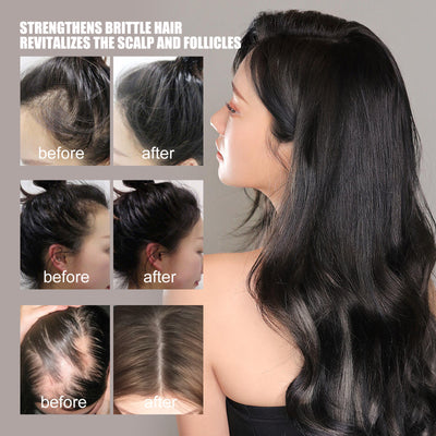 hair growth serum

hair thickening solution

anti-hair loss treatment

nourish hair roots

scalp repair formula

hair regrowth booster

natural hair revitalizer

hair follicle stimulator

healthy hair serum

breakage prevention

hair shine enhancer

daily hair care serum

restore thinning hair

nutrient-rich hair formula

deep hair nourishment

hair repair essence

