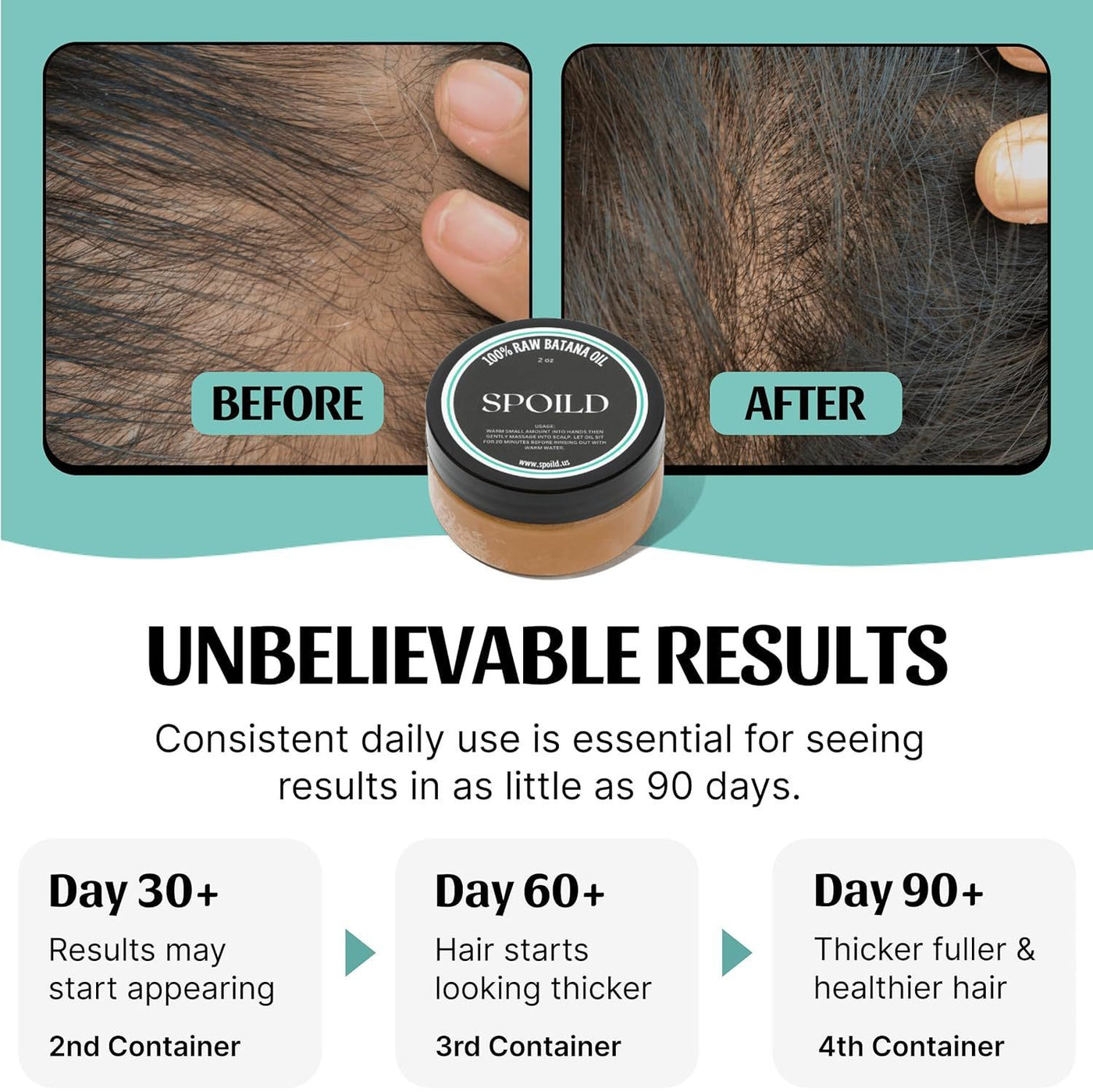 Batana oil for hair

hair growth oil

natural hair repair

hair loss treatment

restore damaged hair

thickening hair oil

scalp stimulation oil

anti-breakage hair serum

omega-rich hair oil

shine enhancing oil

split end repair oil

organic hair care

hair hydration oil

deep nourishing oil

natural hair restoration

